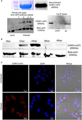 Decoding chikungunya virus non-structural protein 3 interacting partners in THP-1 derived infected macrophages through proteomic profiling